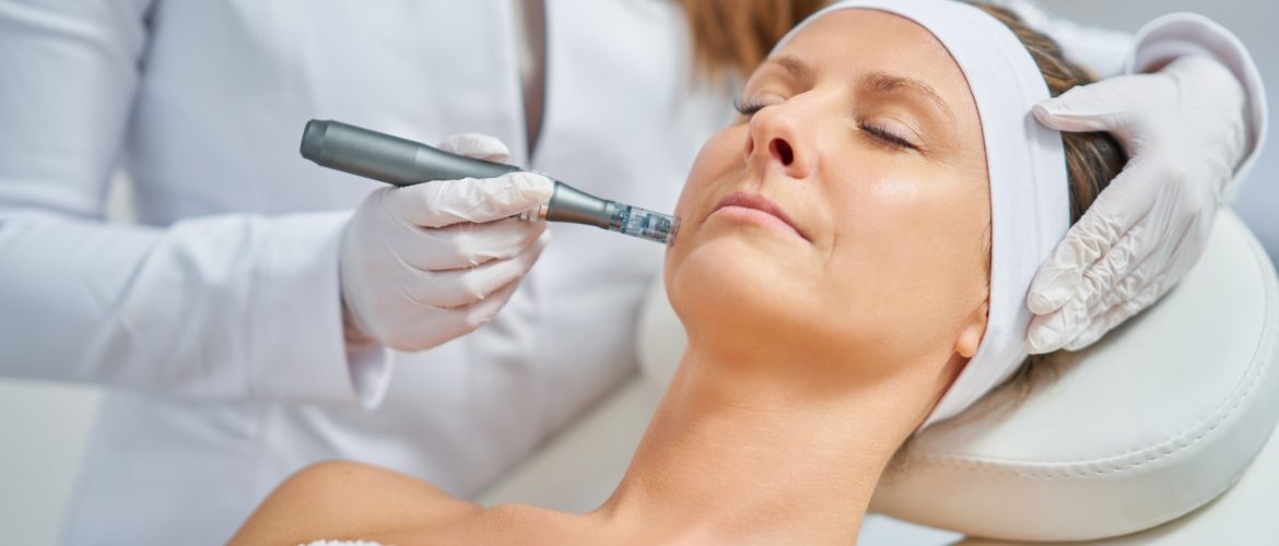 Inside Microneedling: The Hottest Beauty Trend for Your Skin