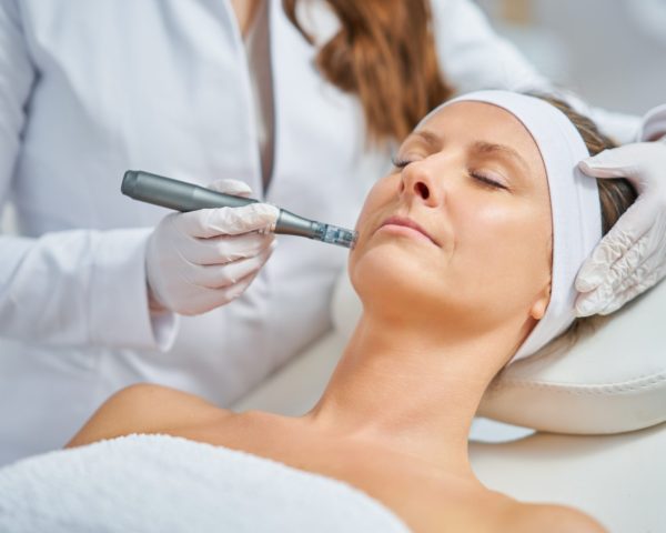 Inside Microneedling: The Hottest Beauty Trend for Your Skin